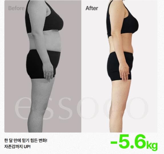 산본역 에소코핏 · EMS 다이어트 순익 455